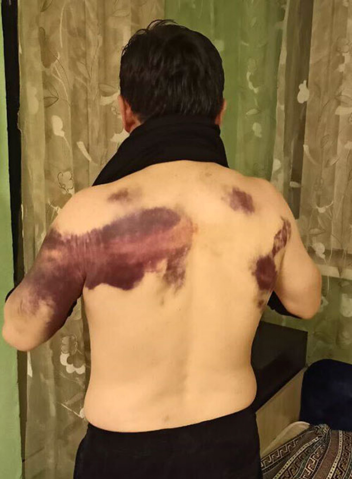 
					Activist Aset Abishev shows bruises he said were caused by repeated beatings from security officers.					 					Facebook				