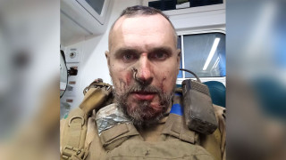 Ukrainian Filmmaker Oleg Sentsov Wounded in War - Vimarsana News