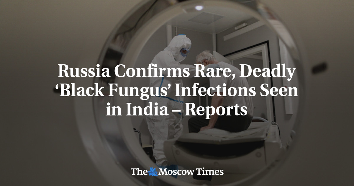 Rusia mengkonfirmasi infeksi ‘jamur hitam’ yang langka dan mematikan yang terlihat di India – laporan