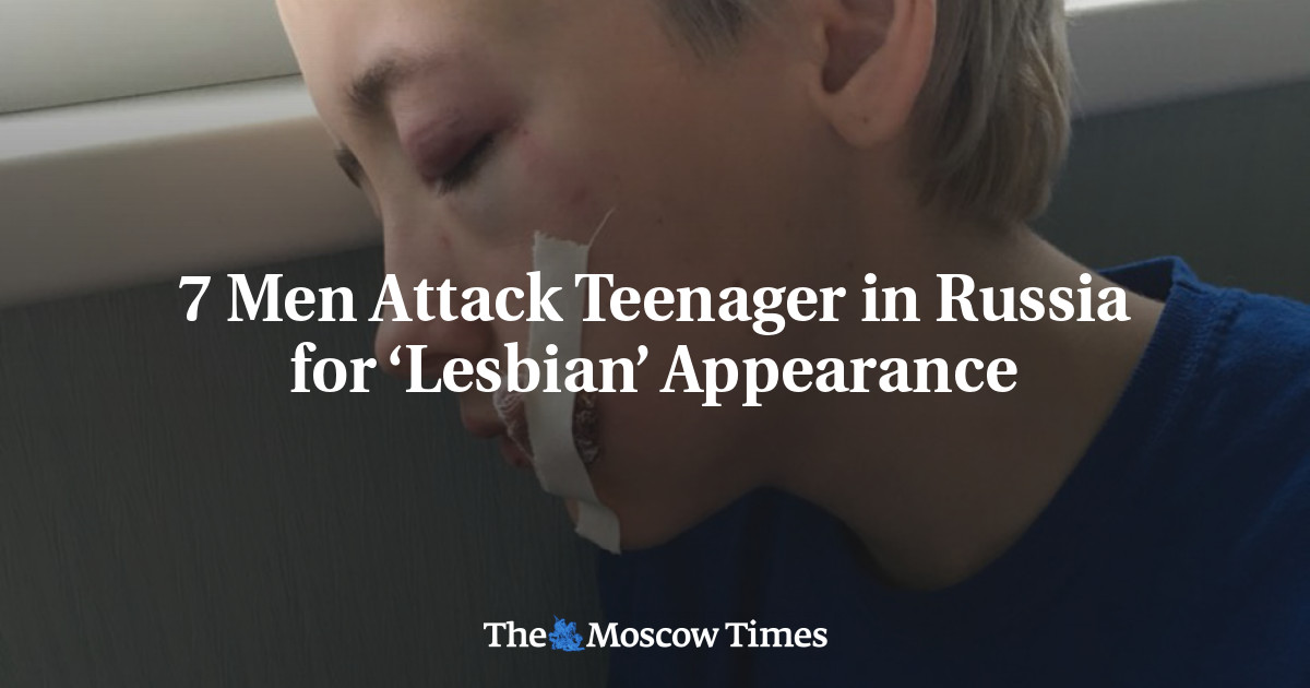 Lesbian Russia